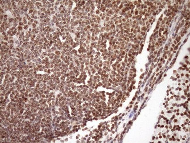 SYF2 Antibody in Immunohistochemistry (Paraffin) (IHC (P))