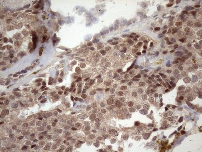 TDG Antibody in Immunohistochemistry (Paraffin) (IHC (P))