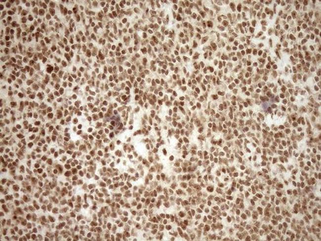 EXOSC1 Antibody in Immunohistochemistry (Paraffin) (IHC (P))