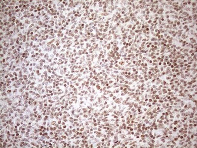 UTP11L Antibody in Immunohistochemistry (Paraffin) (IHC (P))