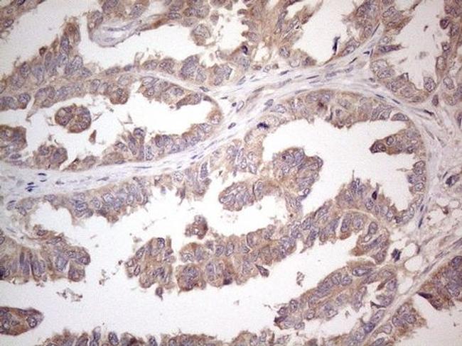 AMTN Antibody in Immunohistochemistry (Paraffin) (IHC (P))