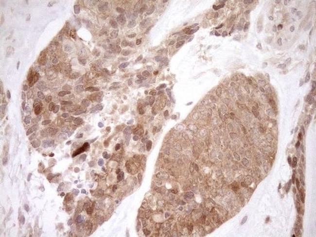 ITPK1 Antibody in Immunohistochemistry (Paraffin) (IHC (P))