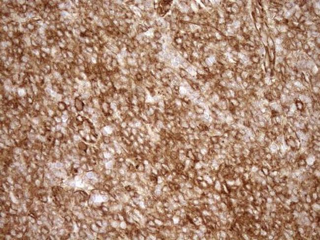 EPLIN Antibody in Immunohistochemistry (Paraffin) (IHC (P))