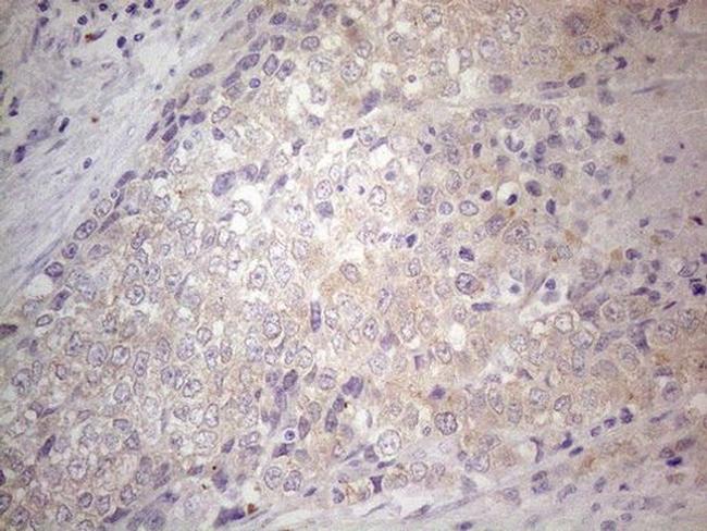 Gemin 2 Antibody in Immunohistochemistry (Paraffin) (IHC (P))