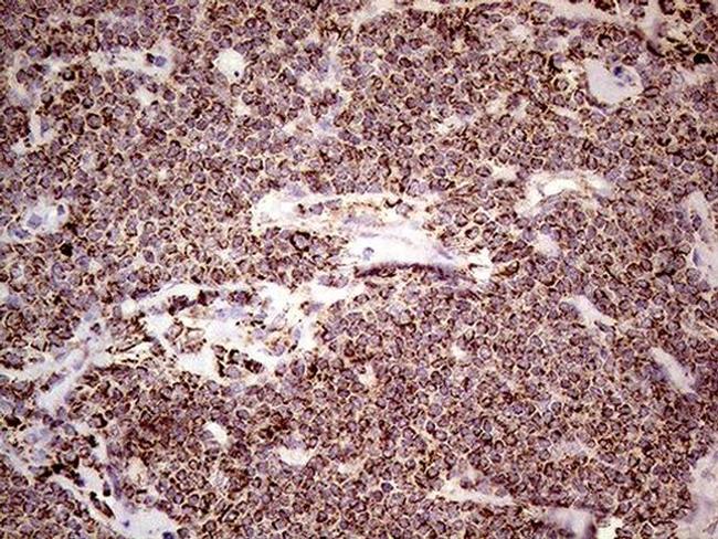 SHMT2 Antibody in Immunohistochemistry (Paraffin) (IHC (P))