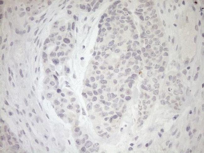 MYOZ1 Antibody in Immunohistochemistry (Paraffin) (IHC (P))