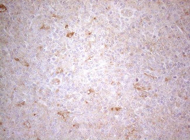 PTK9 Antibody in Immunohistochemistry (Paraffin) (IHC (P))