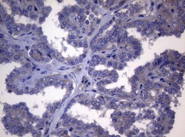 FXR Antibody in Immunohistochemistry (Paraffin) (IHC (P))