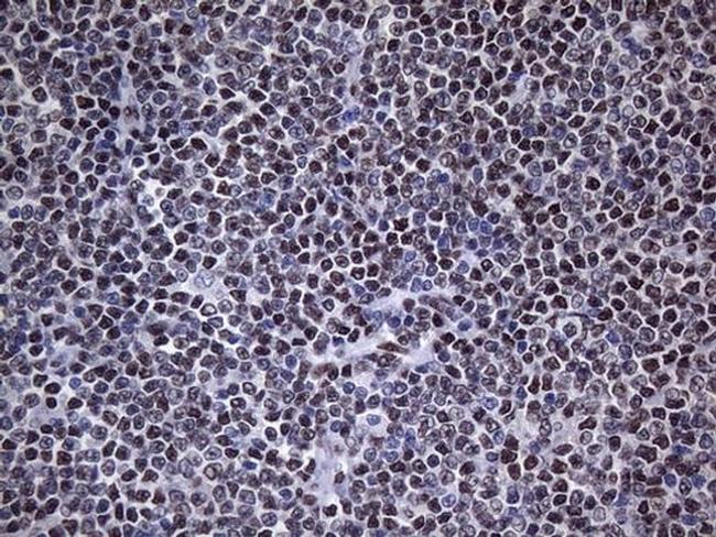 HNRNPA0 Antibody in Immunohistochemistry (Paraffin) (IHC (P))