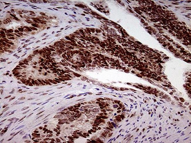 FTO Antibody in Immunohistochemistry (Paraffin) (IHC (P))