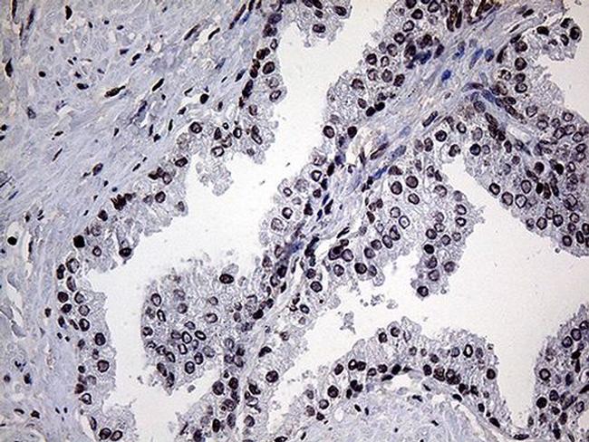 POLR3H Antibody in Immunohistochemistry (Paraffin) (IHC (P))