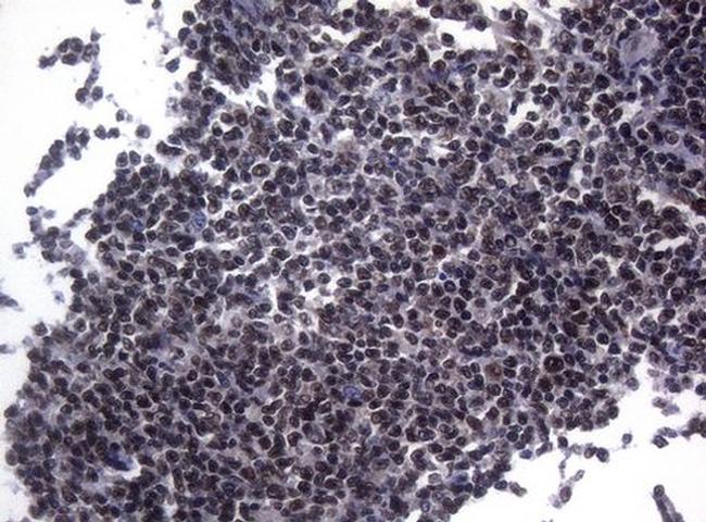 SF1 Antibody in Immunohistochemistry (Paraffin) (IHC (P))