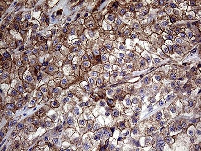 GLS2 Antibody in Immunohistochemistry (Paraffin) (IHC (P))