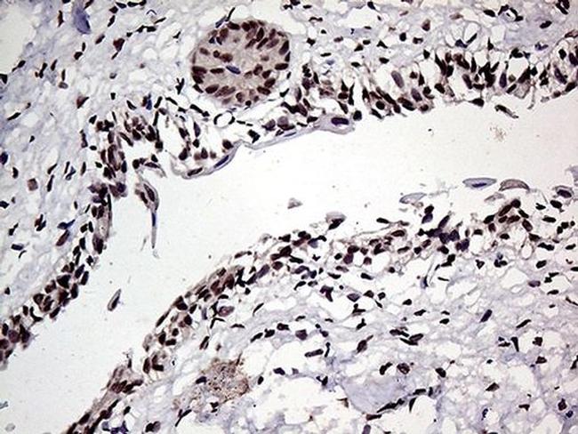 HOXD9 Antibody in Immunohistochemistry (Paraffin) (IHC (P))