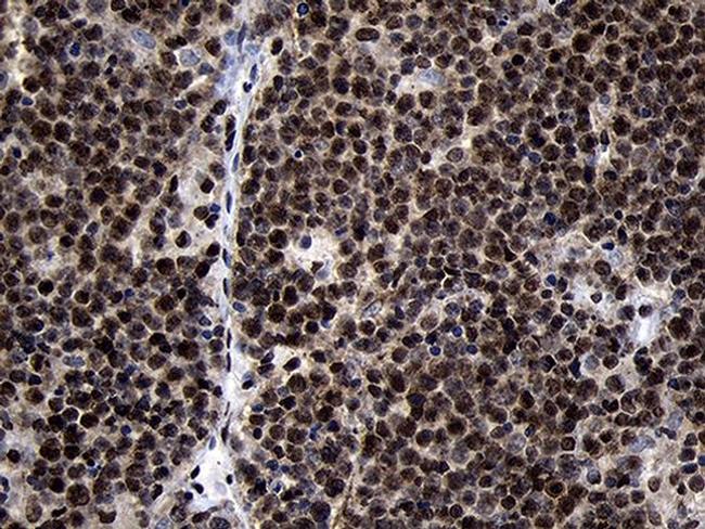 HOXC4 Antibody in Immunohistochemistry (Paraffin) (IHC (P))