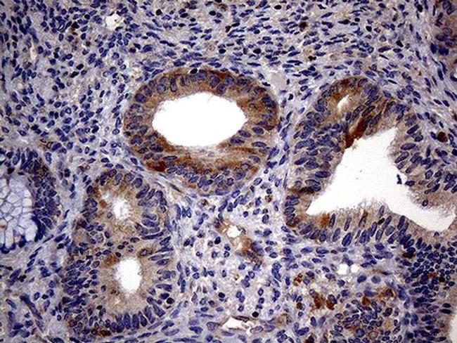 TRIP13 Antibody in Immunohistochemistry (Paraffin) (IHC (P))