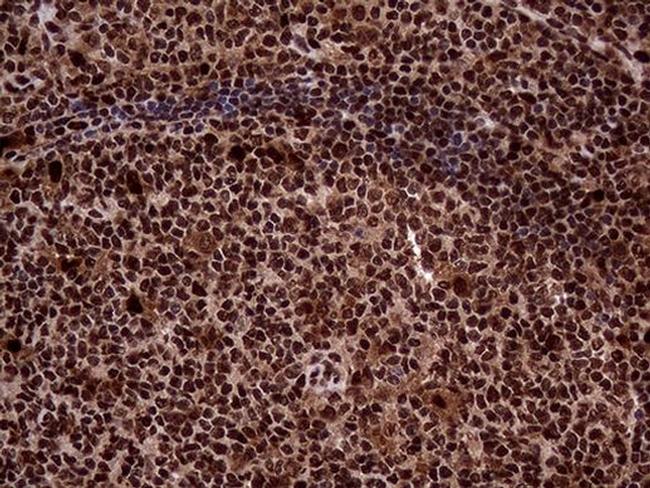 TALDO1 Antibody in Immunohistochemistry (Paraffin) (IHC (P))