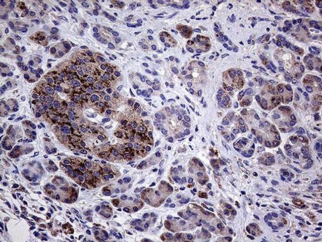 AMDHD1 Antibody in Immunohistochemistry (Paraffin) (IHC (P))