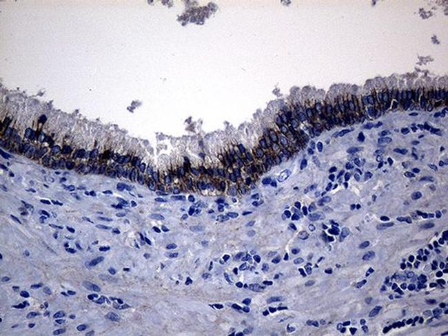 ROR2 Antibody in Immunohistochemistry (Paraffin) (IHC (P))