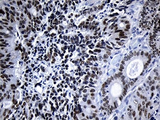 ELF3 Antibody in Immunohistochemistry (Paraffin) (IHC (P))