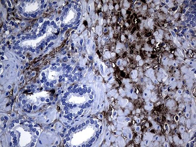 GCH1 Antibody in Immunohistochemistry (Paraffin) (IHC (P))