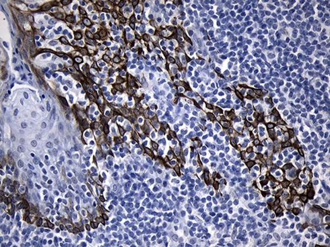 FBXO6 Antibody in Immunohistochemistry (Paraffin) (IHC (P))