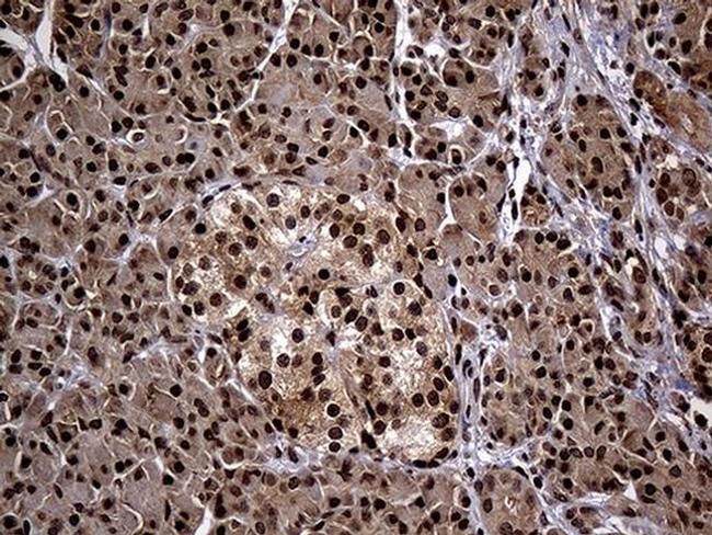 PSMA7 Antibody in Immunohistochemistry (Paraffin) (IHC (P))