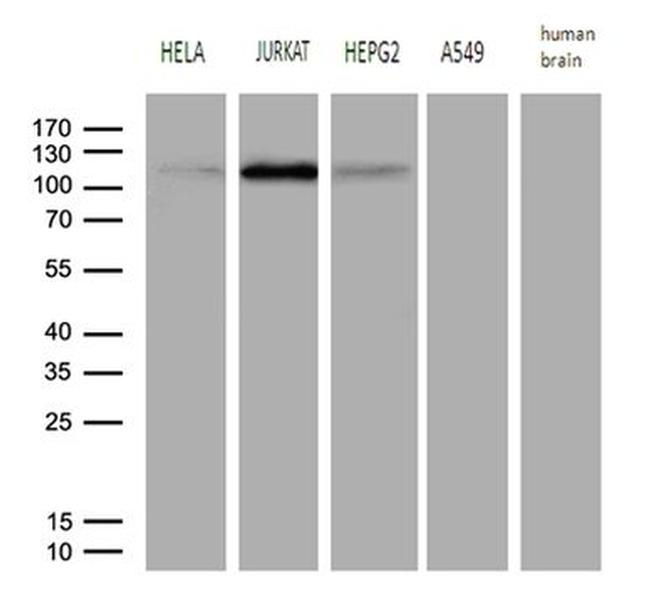 PMS1 Antibody in Western Blot (WB)