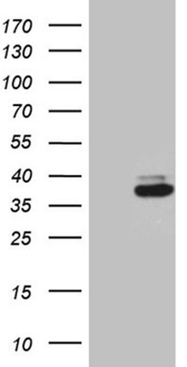 RCAN1 Antibody in Western Blot (WB)