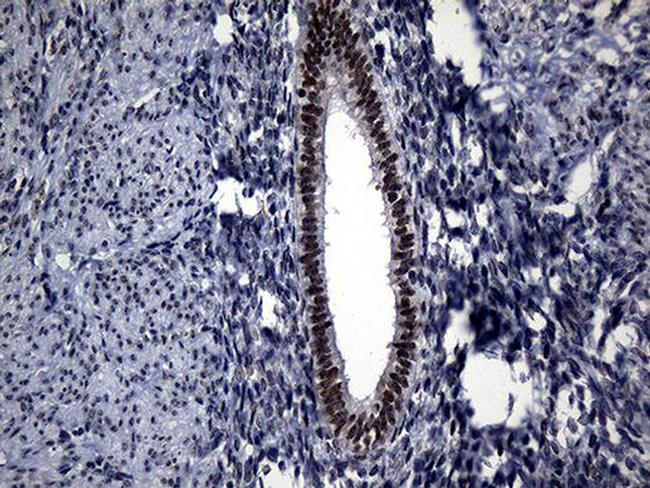 RPAIN Antibody in Immunohistochemistry (Paraffin) (IHC (P))