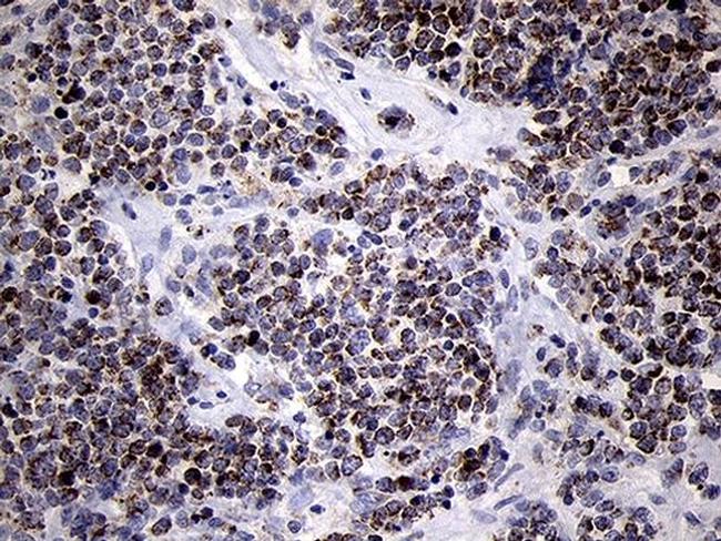 MRPL44 Antibody in Immunohistochemistry (Paraffin) (IHC (P))