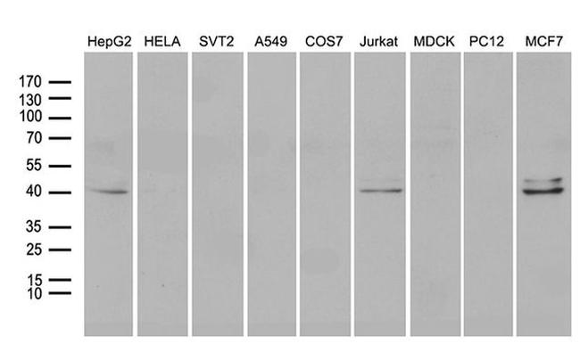 NEUROD4 Antibody in Western Blot (WB)