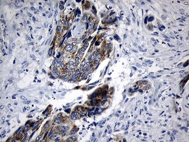 MRPL48 Antibody in Immunohistochemistry (Paraffin) (IHC (P))