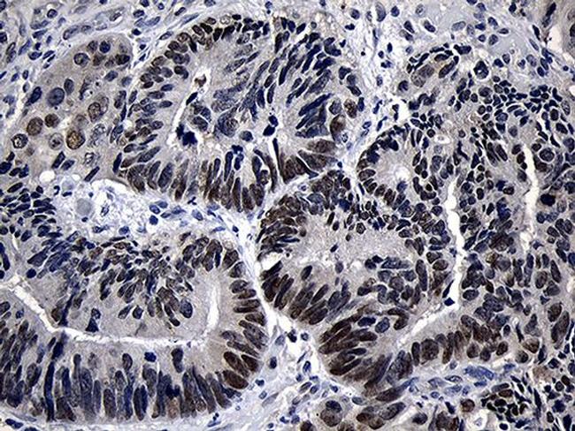 ZKSCAN1 Antibody in Immunohistochemistry (Paraffin) (IHC (P))