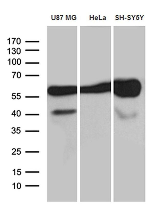 GDI1 Antibody in Western Blot (WB)