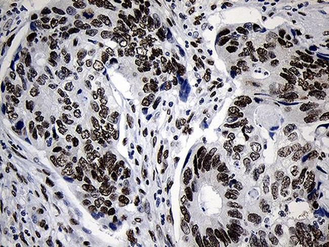 NABP1 Antibody in Immunohistochemistry (Paraffin) (IHC (P))