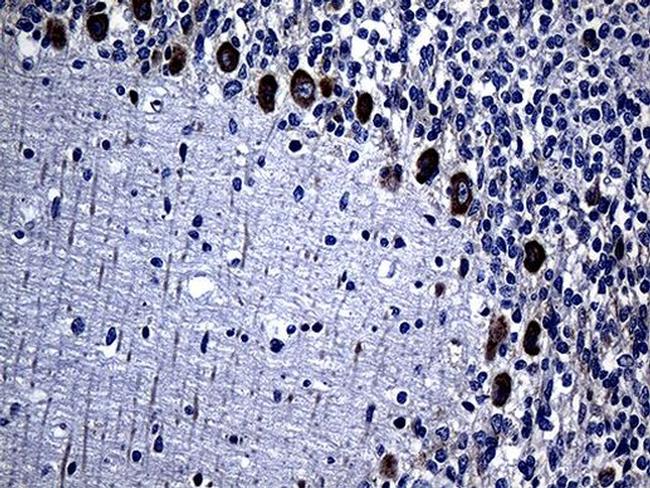 MMGT1 Antibody in Immunohistochemistry (Paraffin) (IHC (P))