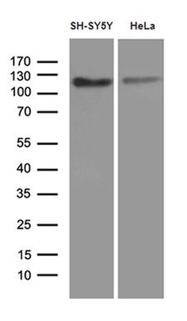 Fe65 Antibody in Western Blot (WB)