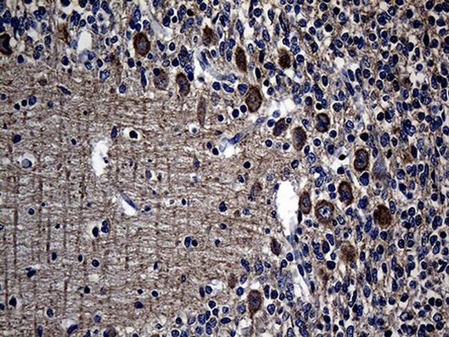 AGO1 Antibody in Immunohistochemistry (Paraffin) (IHC (P))