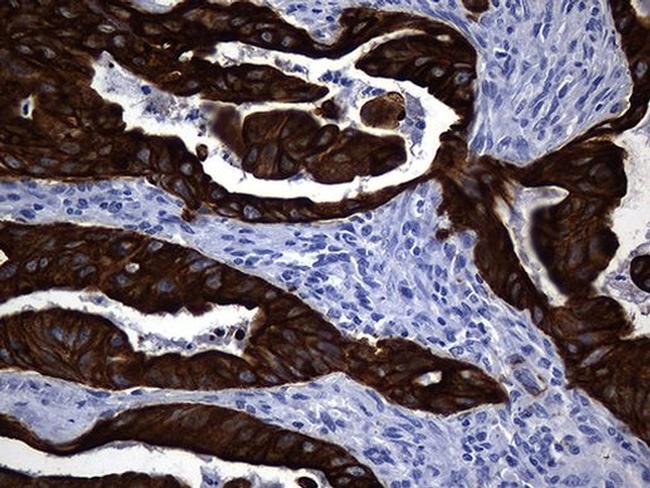 KRT84 Antibody in Immunohistochemistry (Paraffin) (IHC (P))