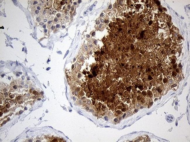 YBX2 Antibody in Immunohistochemistry (Paraffin) (IHC (P))