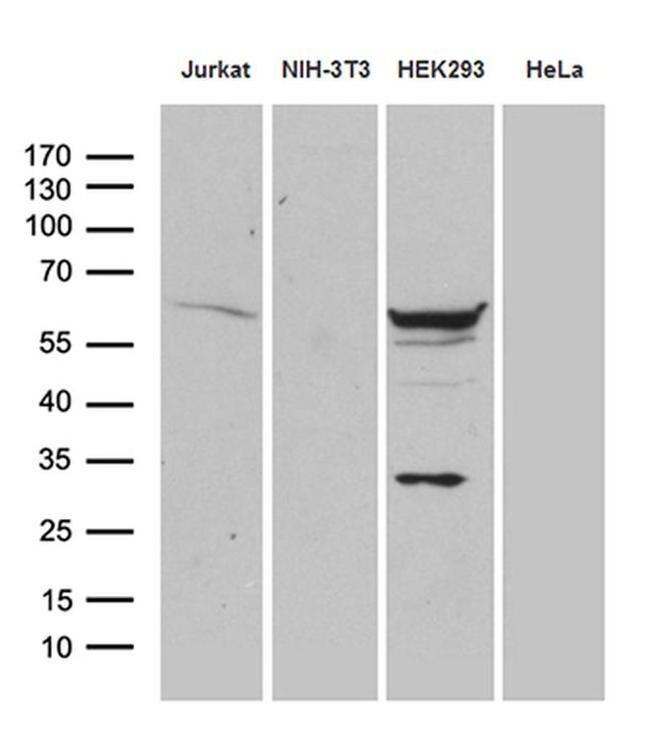 PPP2R1B Antibody in Western Blot (WB)