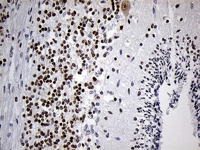 DLX1 Antibody in Immunohistochemistry (Paraffin) (IHC (P))