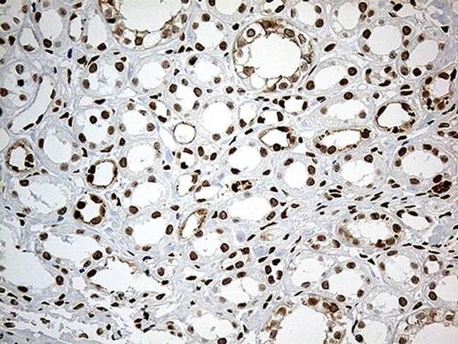 MBD1 Antibody in Immunohistochemistry (Paraffin) (IHC (P))