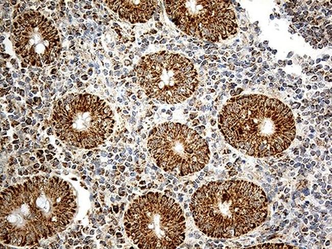 ATP5I Antibody in Immunohistochemistry (Paraffin) (IHC (P))