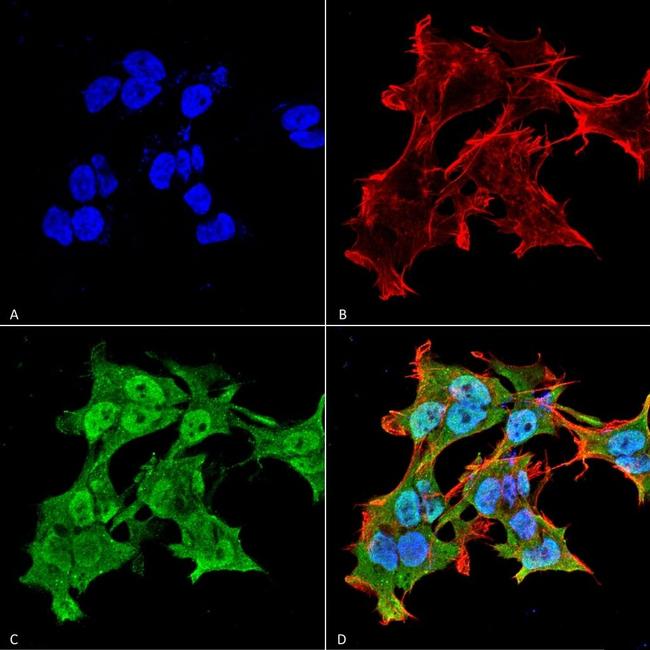 Alpha A Crystallin Antibody in Immunocytochemistry (ICC/IF)