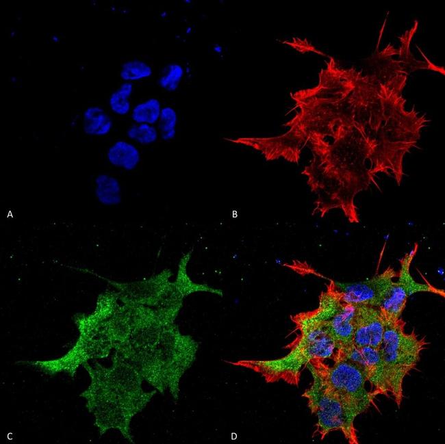 NALCN Antibody in Immunocytochemistry (ICC/IF)