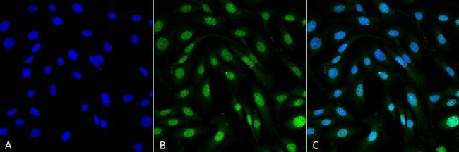 MDC1 Antibody in Immunocytochemistry (ICC/IF)