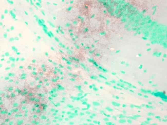 KCNQ1 Antibody in Immunohistochemistry (Paraffin) (IHC (P))