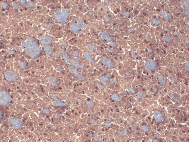 GABRB3 Antibody in Immunohistochemistry (Paraffin) (IHC (P))